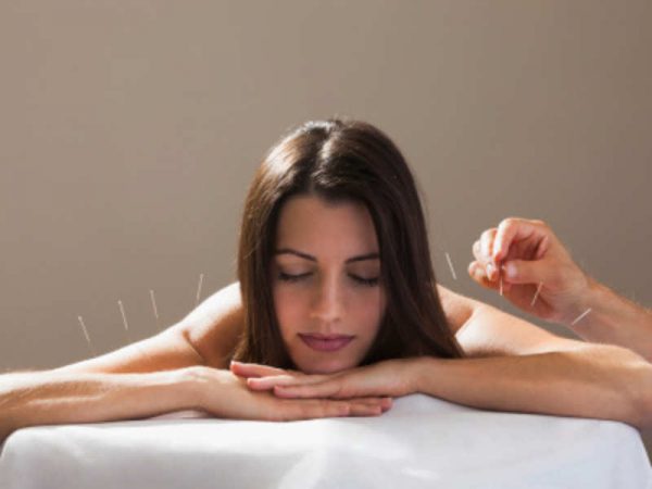 Benefits of acupuncture