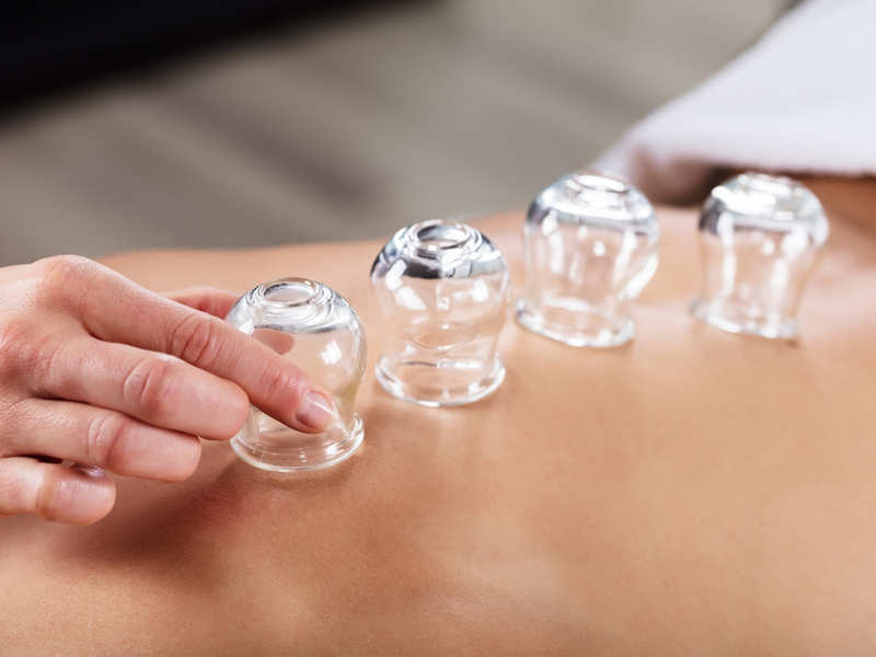 Here's why celebrities are raving over cupping therapy!