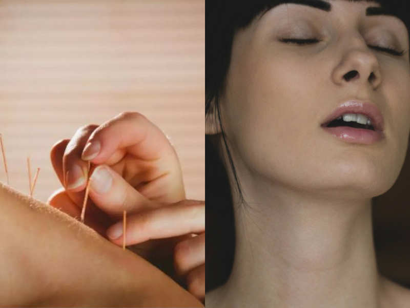 Acupuncture for mindblowing sex: 3 ways it can improve your sex life