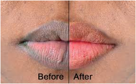The Ultimate Revelation Of How To Lighten Dark Lips Permanently